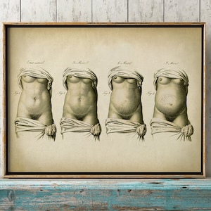 Pregnancy Anatomy Print, Fetus Vintage Anatomy Poster, Pregnant Medical Wall Art, Mom Anatomy Poster, Scientific Anatomy Print, Home Decor