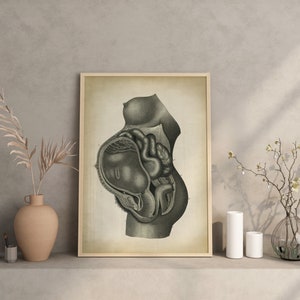 Pregnancy Anatomy Print, Fetus Vintage Anatomy Poster, Pregnant Medical Wall Art, Mom Anatomy Poster, Scientific Anatomy Print, image 4