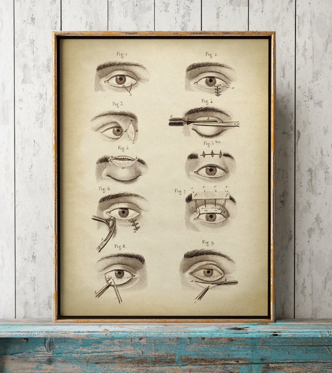 EYES Anatomy Print, Anatomy Poster, Anatomical Drawing, Scientific ...