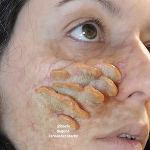 May include: Close-up of a person's face with a realistic special effects makeup application. The makeup appears to be a fleshy, orange-colored growth on the cheek. The text '@bbsfx Bego&ntilde;a Fernandez Martin' is visible in the lower right corner of the image.