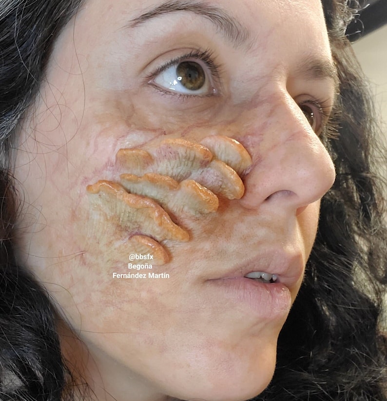 May include: Close-up of a person's face with a realistic special effects makeup application. The makeup appears to be a fleshy, orange-colored growth on the cheek. The text '@bbsfx Bego&ntilde;a Fernandez Martin' is visible in the lower right corner of the image.