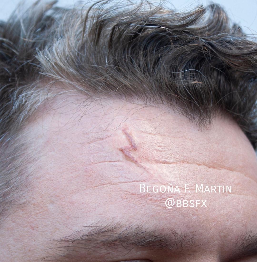 Scar Prothesis Harry Potter Scar Prosthetic: Unpainted Silicone Cosplay SFX - Etsy