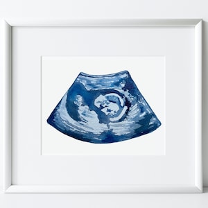 Custom Ultrasound Painting, Watercolor Ultrasound, Custom Sonogram Painting, Ultrasound Art, Sonogram Art
