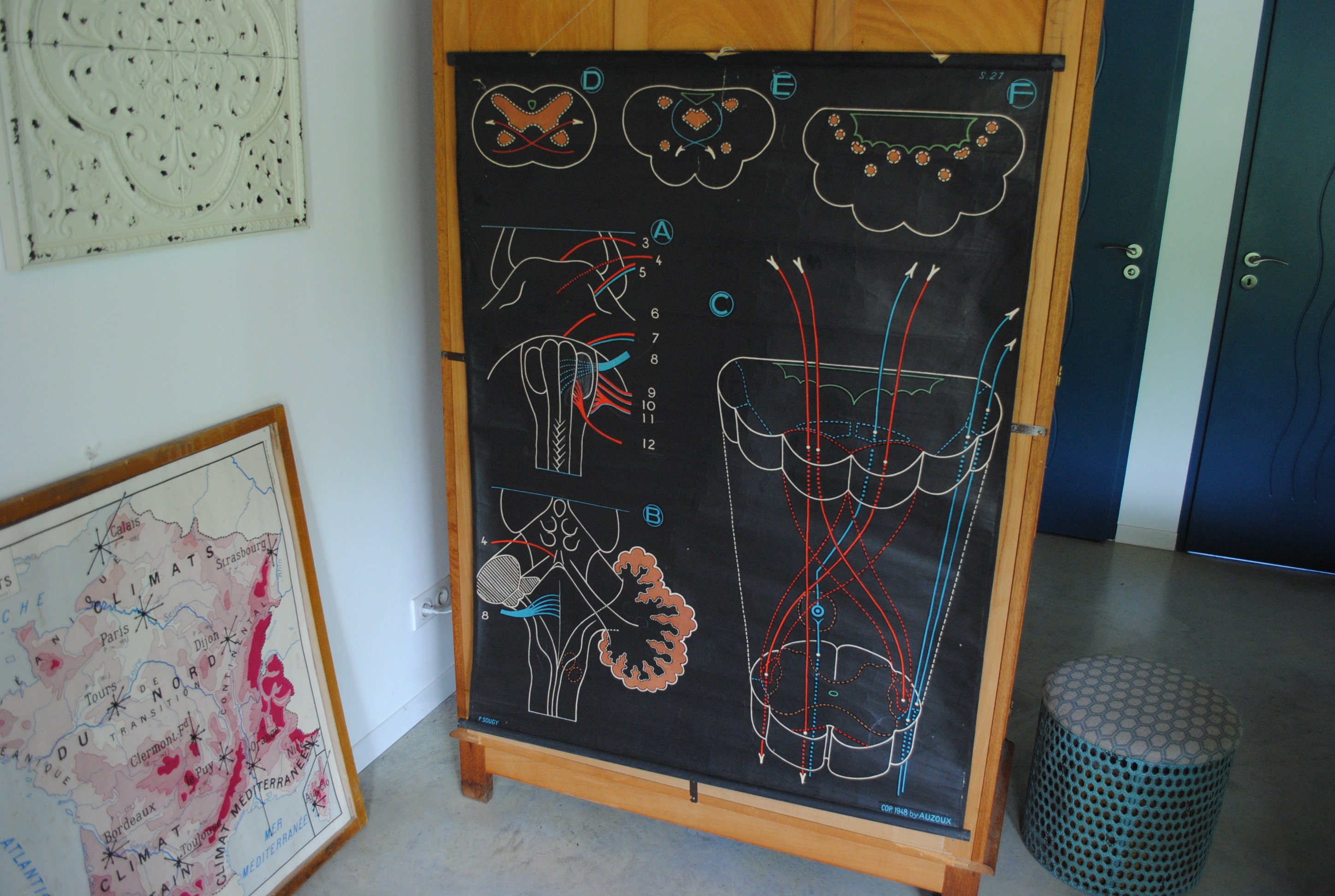 Affiche Scolaire Vintage Dr Auzoux Bulbe Rachidien S27 1948