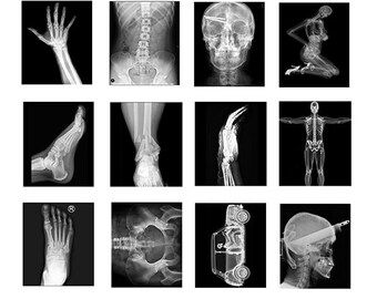 miniature 1:25 G scale model hospital medical X-Rays