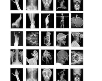 miniature 1:25 G scale model hospital medical X-Rays