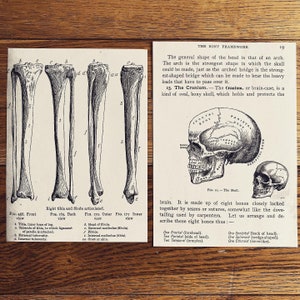 vintage medical prints, anatomy bone illustration, gothic wall decor, oddities, curiosities