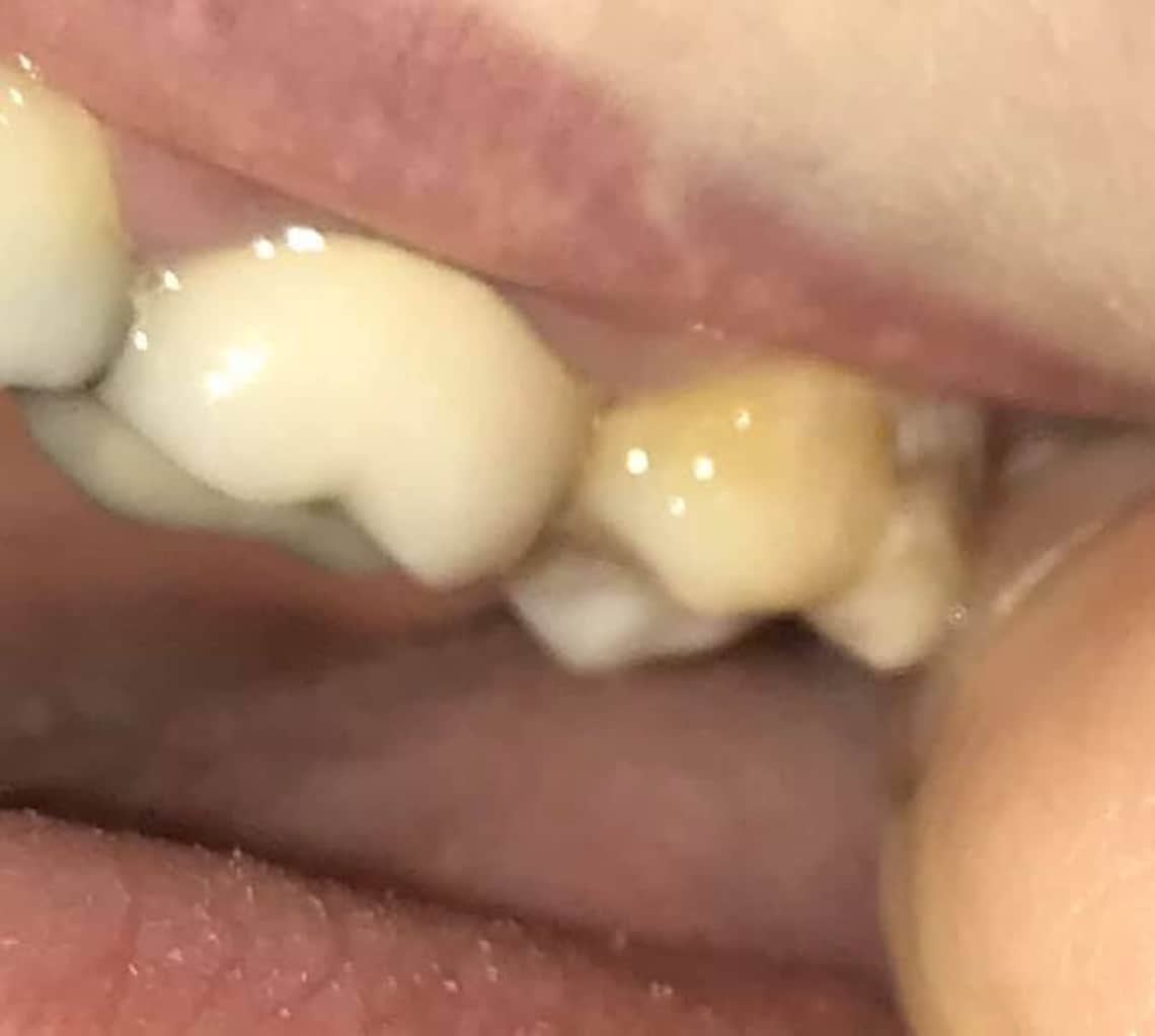 4oz Ozonated Remineralizing Coconut Tooth Oil Tooth and Body Etsy