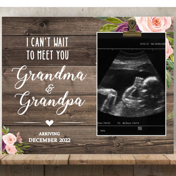 Ultrasound Frame Etsy