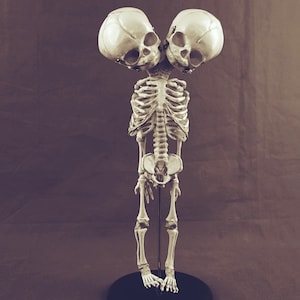 Double-Headed Anatomy Skeletal Model Fetus, Skeleton, Skull, Bizarre, Cabinet of Curiosities