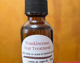 Frankincense Oil