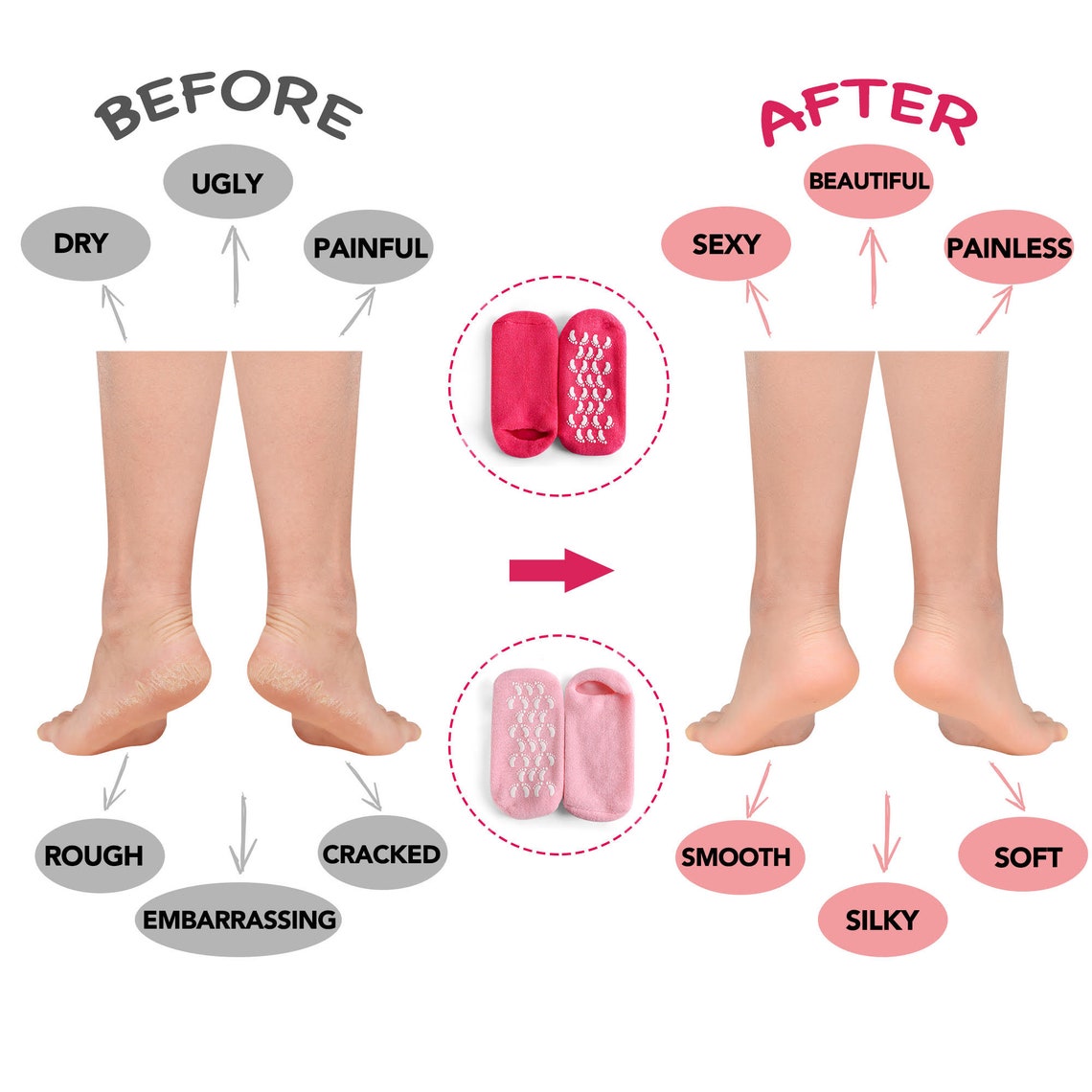 Moisturizing Socks for Dry Feet Gel Socks for Cracked Heels Etsy