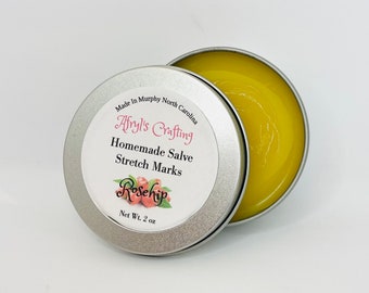 Homemade Stretch Marks Salve Ointment Balm