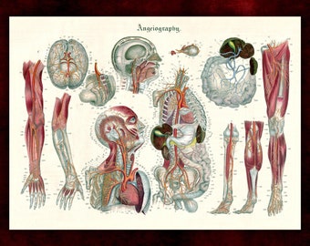 Angiographie von Nicolas Henri Jacob Anatomie Kunstdruck • Dark Academia Leinwanddruck • Viktorianische Ästhetik • Gotische Wohndekoration