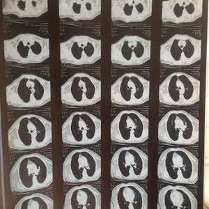 Echte HUMAN XRAYS, große Radiographie Tech Geschenk Acetat 35x43cm Lot von 7