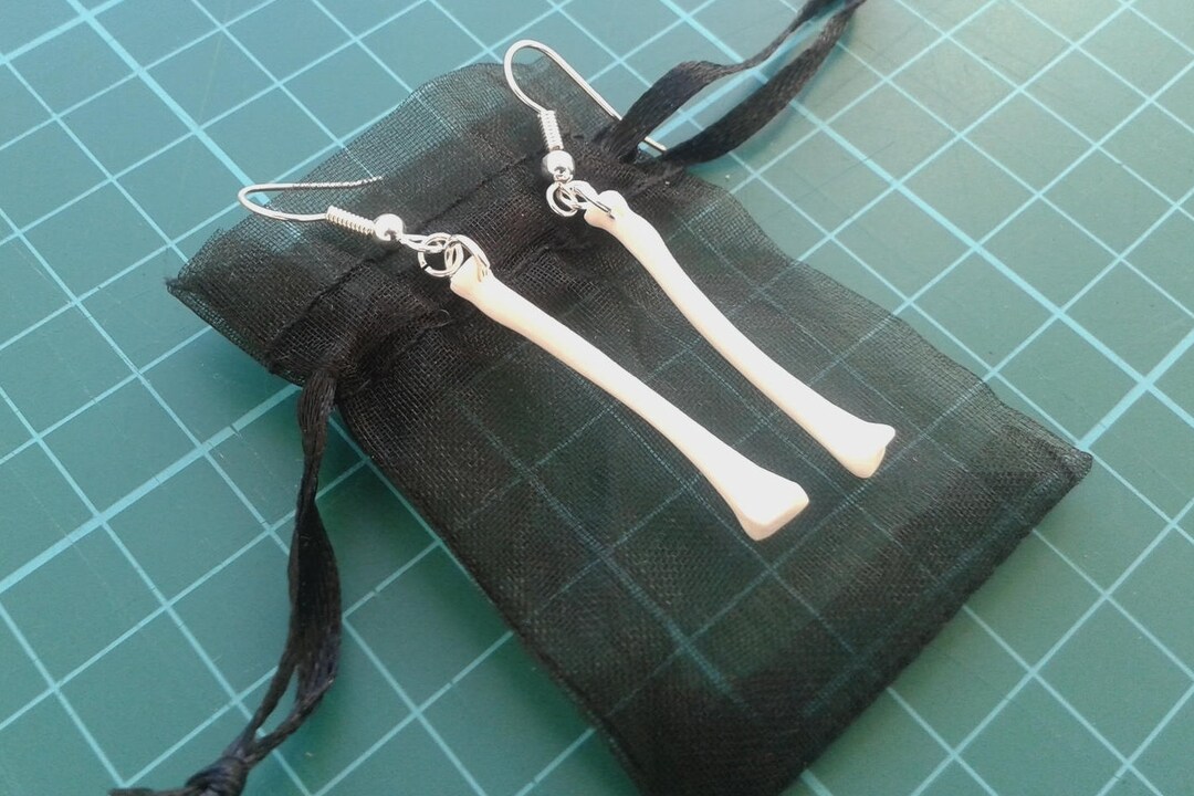 Anatomical Radius Earrings | Medicine | Medical | Orthopedic | Anatomy ...
