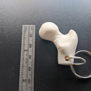Anatomical Femur key ring keychain feat. common fractures medicine medical orthopedic gift anatomy bone surgery surgeon image 4