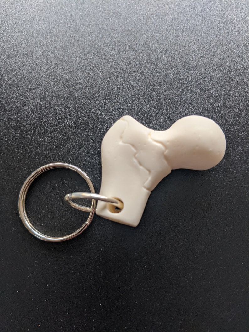 Anatomical Femur key ring keychain feat. common fractures medicine medical orthopedic gift anatomy bone surgery surgeon image 2