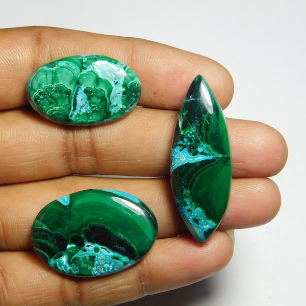 3 Pcs. Rare Collection Of  Very Rare & Gorgeous Azurite Malachite Cabochon Lot Very High Quality Cabochon,Natural Loose Gemstone 103Cts.