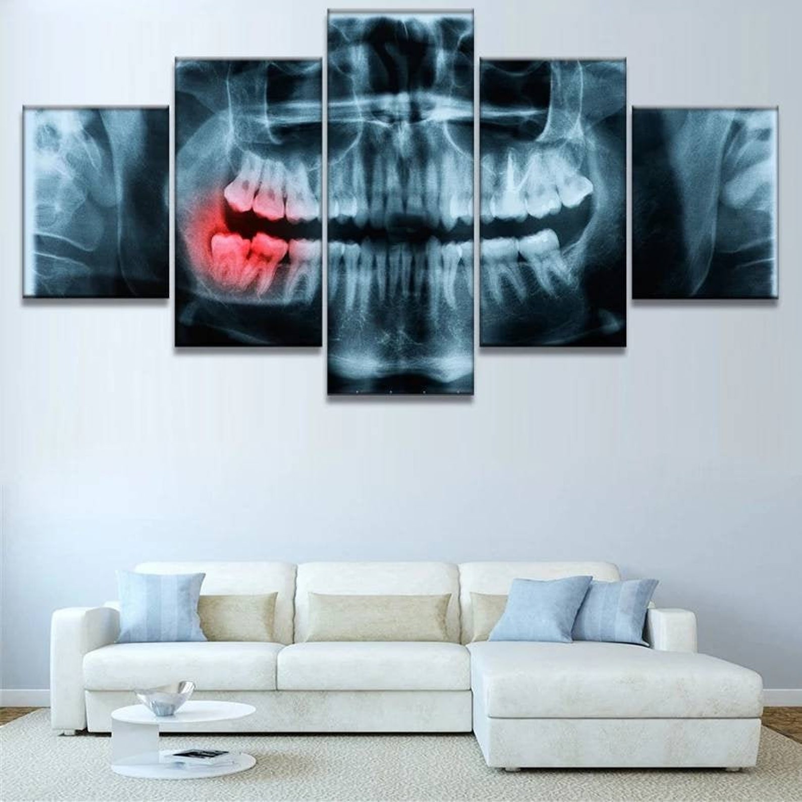 Dental Office Canvas Wall Art Dentist Xray Canvas Set Etsy