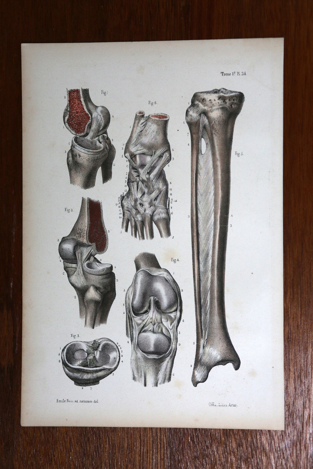 Antique Anatomy Print - 1844 - Ligaments of the Leg & Foot - Etsy UK
