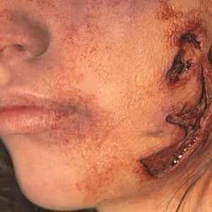 Silicone prosthetics Cuts C13+Z9 - Platinum silicone gel with cap plastic edges