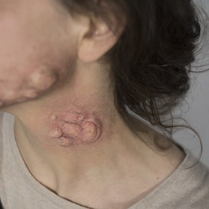 Silikonprothetik Lacerations GH1-GH2-Platin-Silikongel mit Kappe Kunststoffkanten.