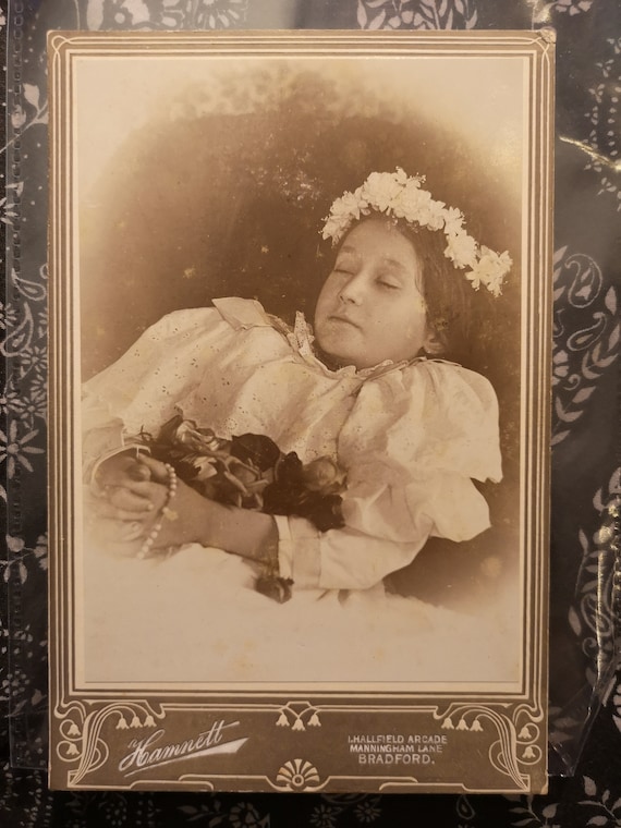 Покажи умерших. Post mortem викторианской эпохи. Post mortem викторианской эпохи. Человек краб. Мертвые дети пост мортем.