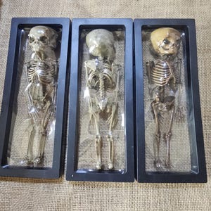 May include: Three human-like skeletal figures encased in individual rectangular black frames with clear protective covers. Each skeleton is positioned vertically, displaying a skull, rib cage, spine, and limb bones in a beige and brown tone.