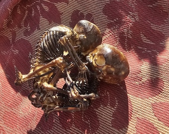 embraced twins fetal skeleton model
