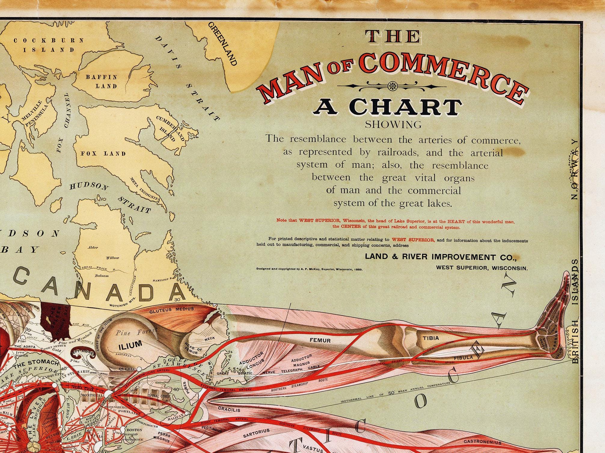 Commerce Historically Man of Commerce Historical Map Art Print: Anatomy & Railroads - Etsy ...