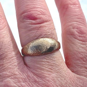 Bague rayée et marquée - La vie peut être dure, surtout pour le visage !