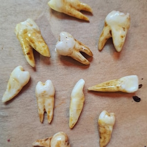 Può includere: Una collezione di dieci denti, ciascuno di colore bianco crema e con vari gradi di macchie marroni. I denti sono di diverse dimensioni e forme, tra cui molari e incisivi. I denti sono disposti su una superficie marrone chiaro.