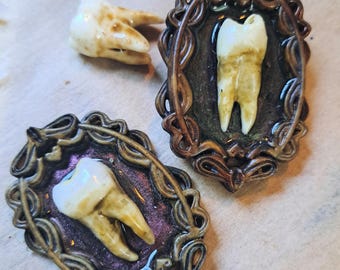 Horror, curiosidad, dientes humanos, imanes