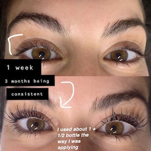 Eyelash and Eyebrow Serum