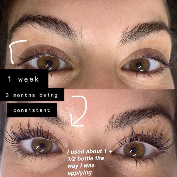 Eyelash and Eyebrow Serum