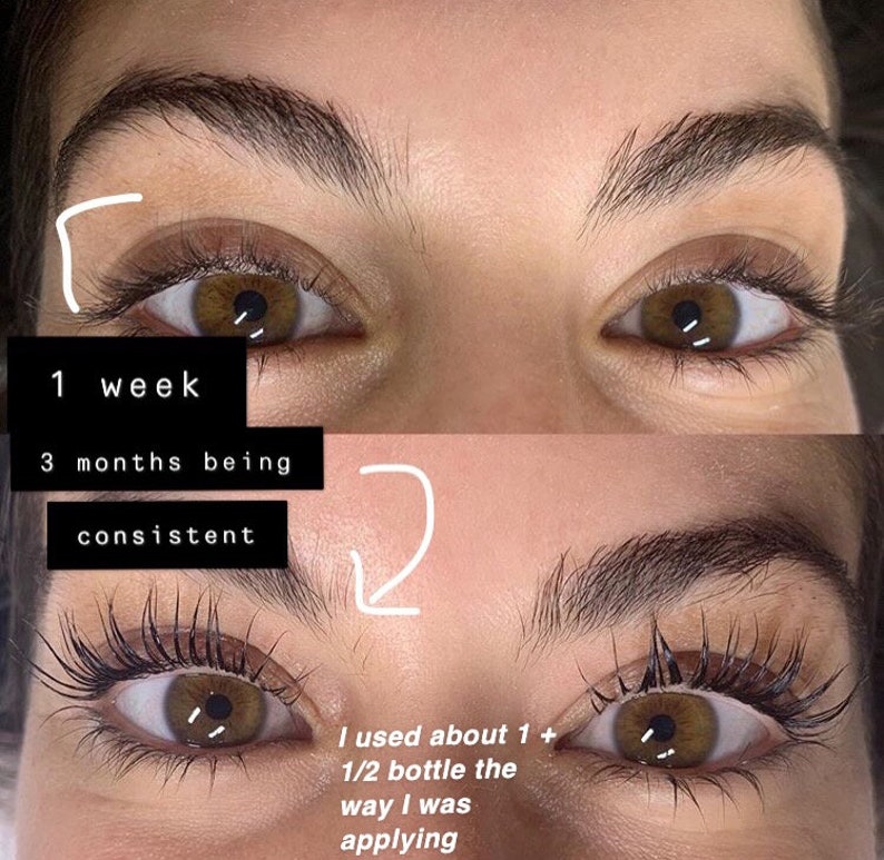 Eyelash Growth Serum