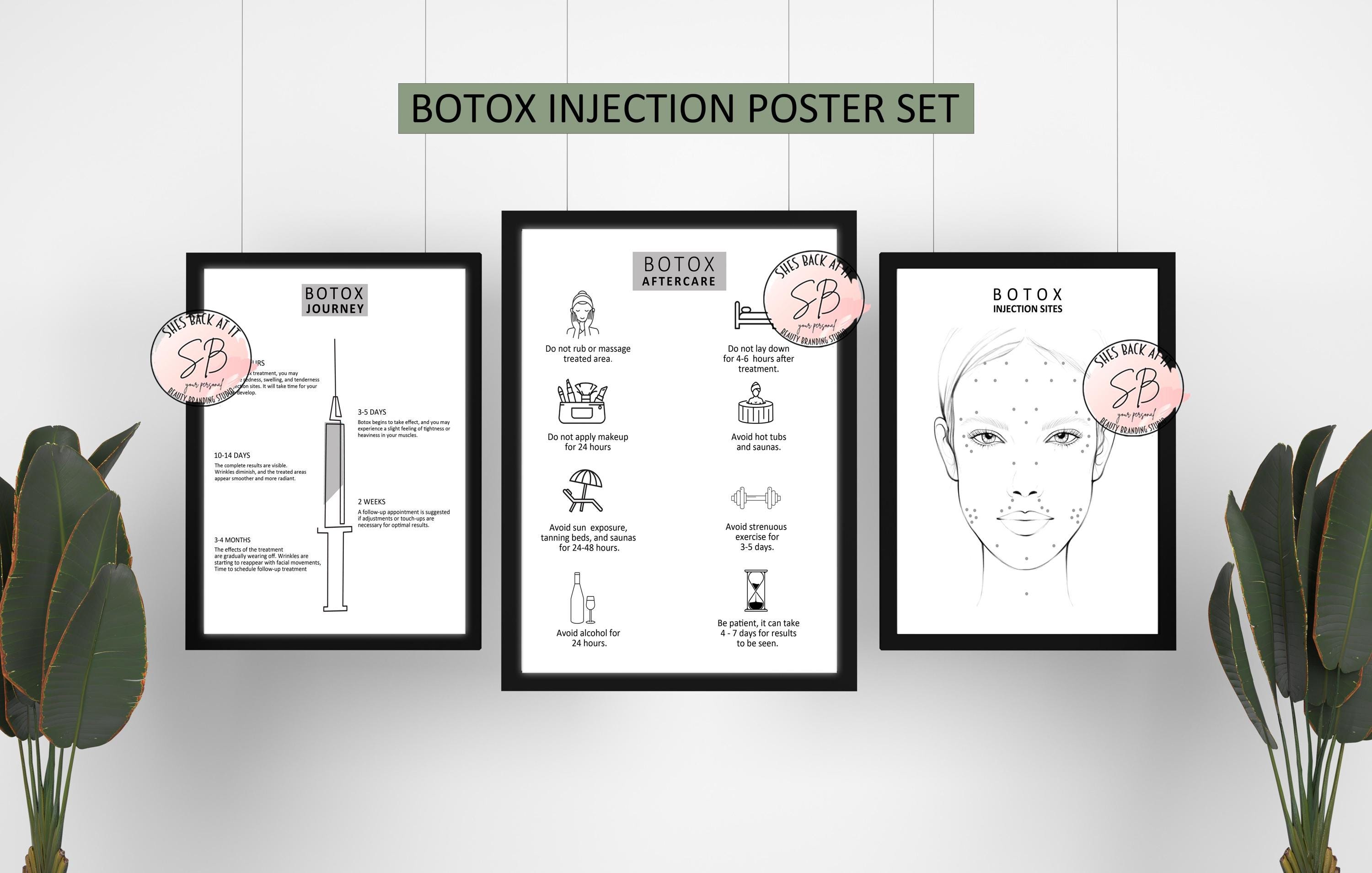 Botox Journey Poster Set of 3, Training Poster, Botox Injection Site ...