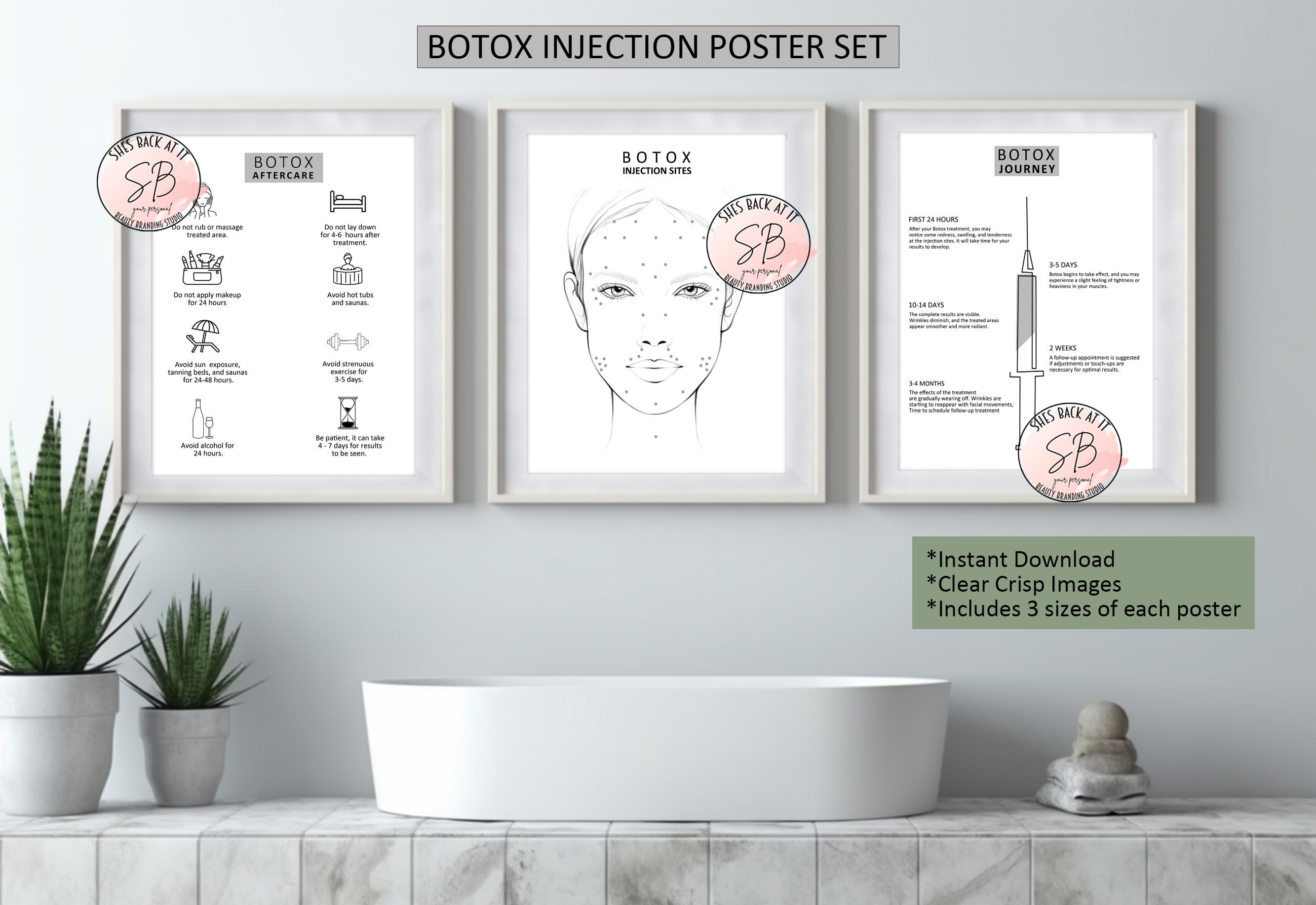 Botox Journey Poster Set of 3, Training Poster, Botox Injection Site ...