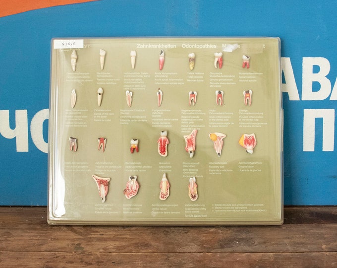 Vintage Somso Model Case of Teeth Odontopathies