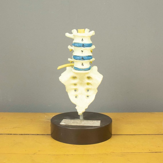 Vintage Anatomical Model of the Human's Lower Back Vertebrae and Sacral Vertebrae