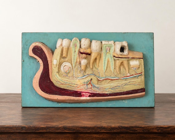 Educational Vintage Plaster Model for Dental Medicine