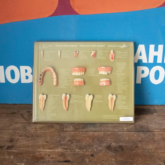 Vintage Somso Model Case of Teeth