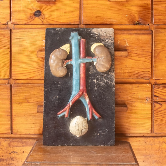 Vintage Anatomical Kidney & Urinary System Model