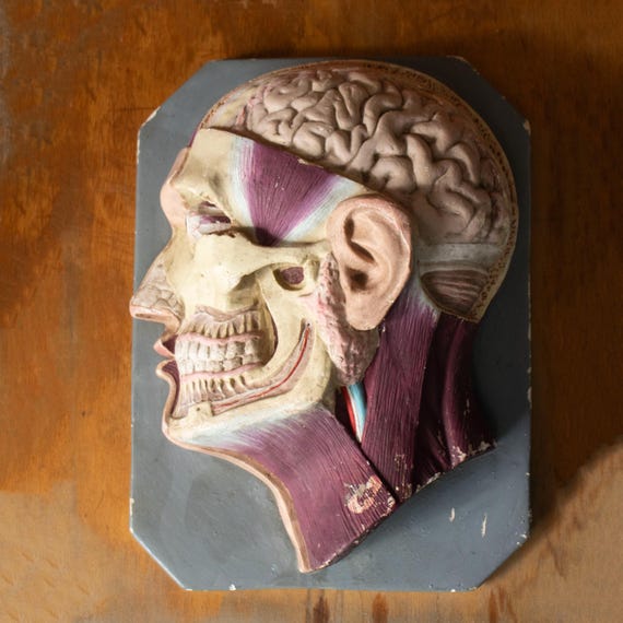Antique Bulgarian Plaster Anatomical Model – Human Head Cross-Section