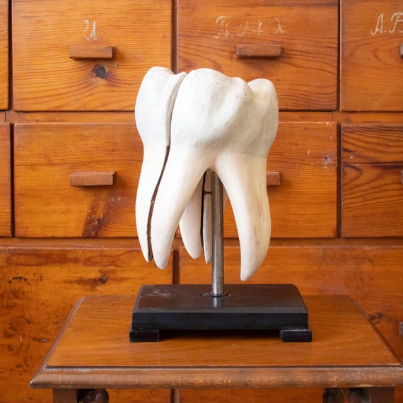 Vintage Romanian Anatomical Tooth Model – Large Dental Teaching Model