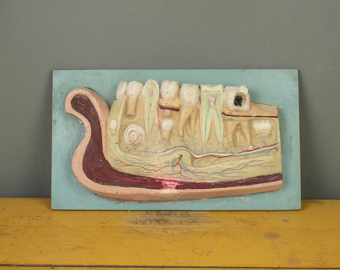 Educational Vintage Plaster Model for Dental Medicine