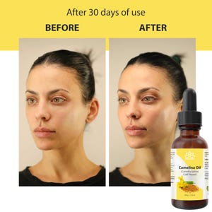 Peut inclure: Image comparant l'apparence de la peau avant et apr&egrave;s l'utilisation de l'huile de cam&eacute;line. Le c&ocirc;t&eacute; gauche montre le visage d'une femme avant utilisation, et le c&ocirc;t&eacute; droit apr&egrave;s 30 jours. Une bouteille marron d'huile de cam&eacute;line est au premier plan.