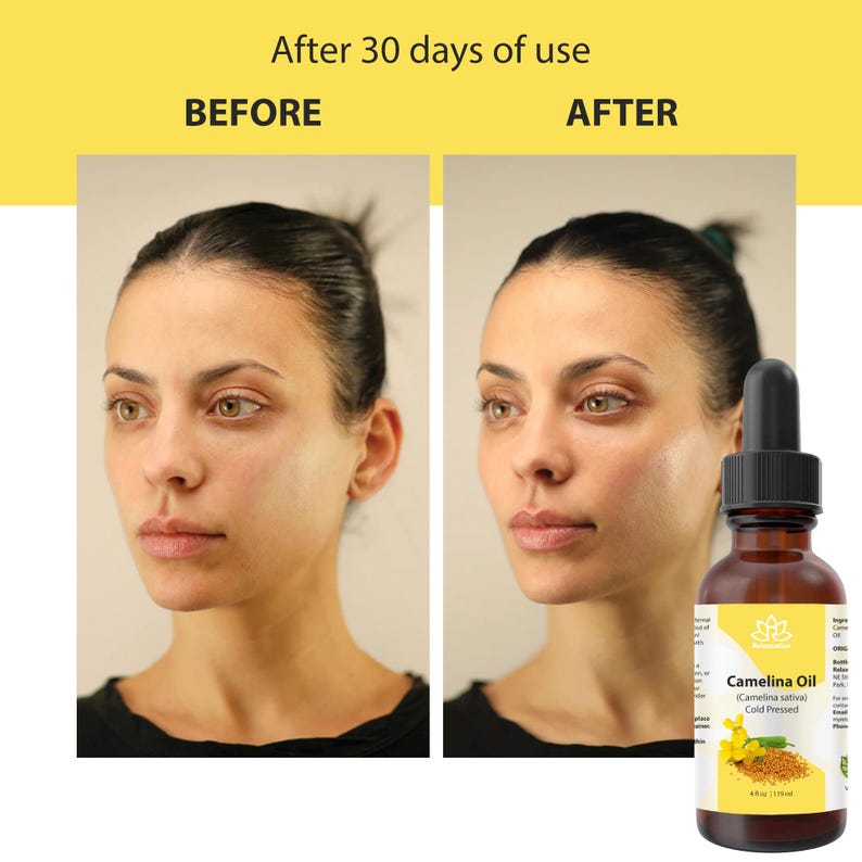 Peut inclure: Image comparant l'apparence de la peau avant et apr&egrave;s l'utilisation de l'huile de cam&eacute;line. Le c&ocirc;t&eacute; gauche montre le visage d'une femme avant utilisation, et le c&ocirc;t&eacute; droit apr&egrave;s 30 jours. Une bouteille marron d'huile de cam&eacute;line est au premier plan.