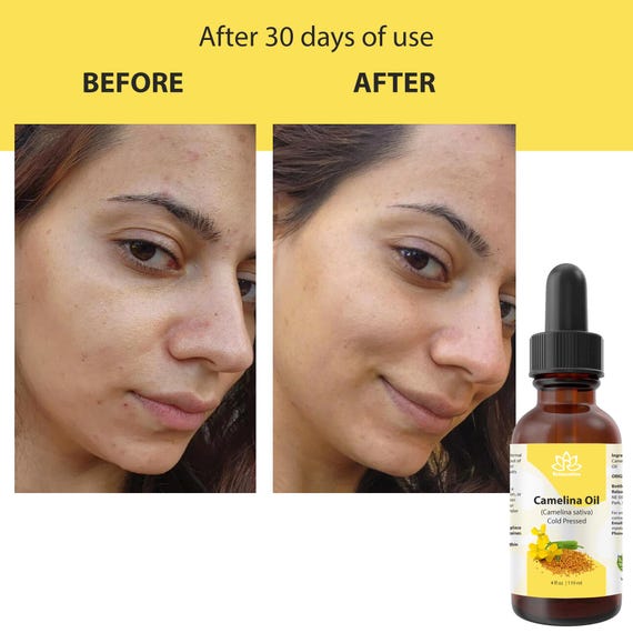 nemau vap shop Vitamin E Oil for Skin 2022